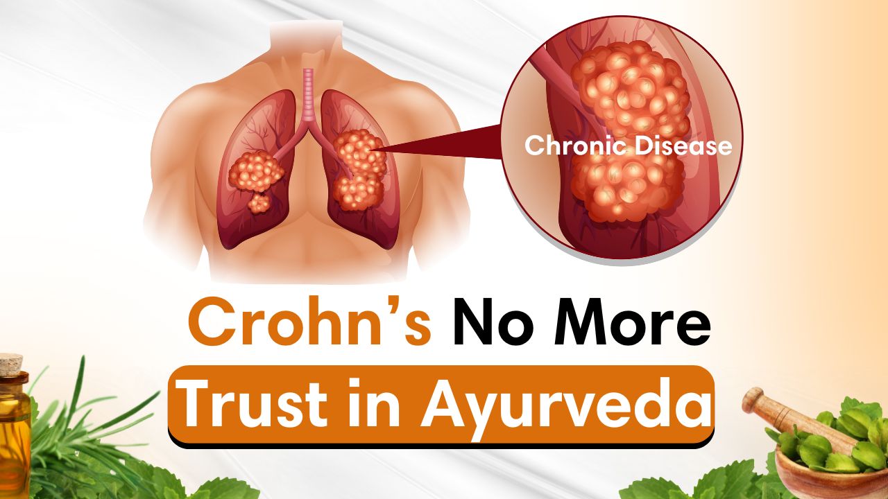 Crohnโs Disease Through the Ayurvedic Lens: A Classical Remedial Strategy by Deep Ayurveda, Tricityโs Premier Centre