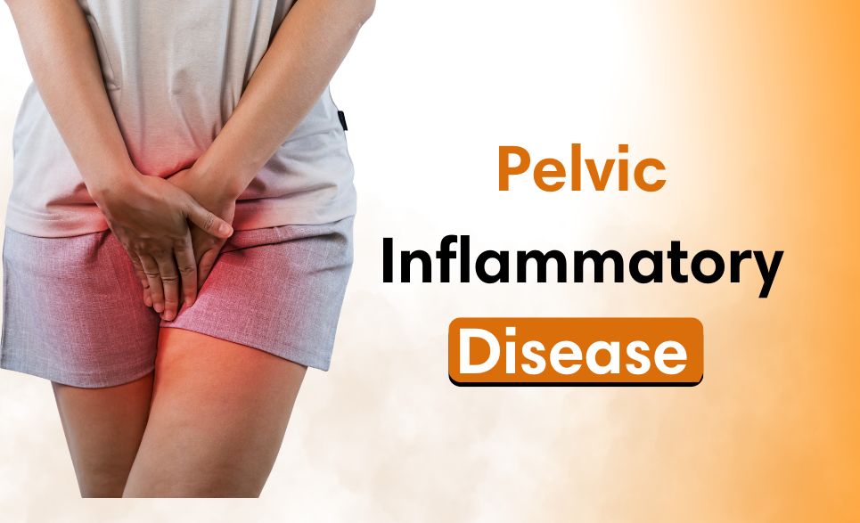 Pelvic Inflammatory Disease, Cervicitis