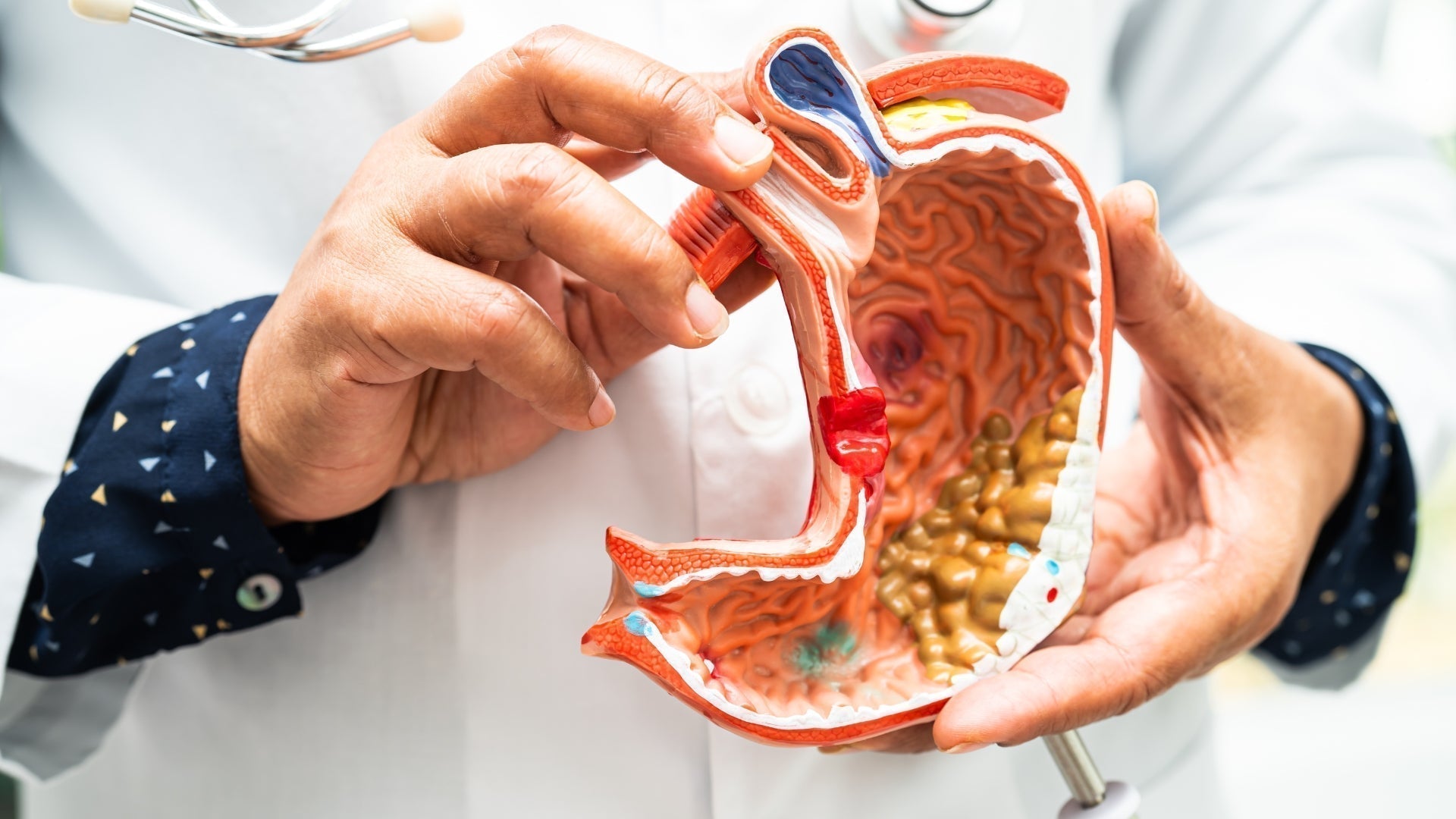 ayurveda's secrets of healthy digestion