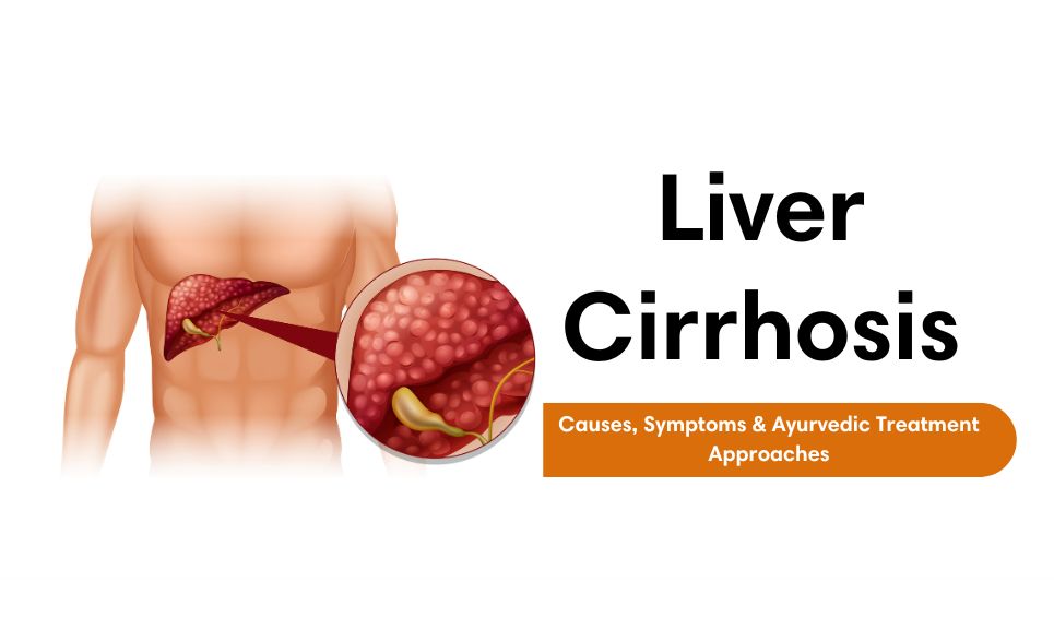 Liver Cirrhosis: Causes, Symptoms & Ayurvedic Treatment Approaches