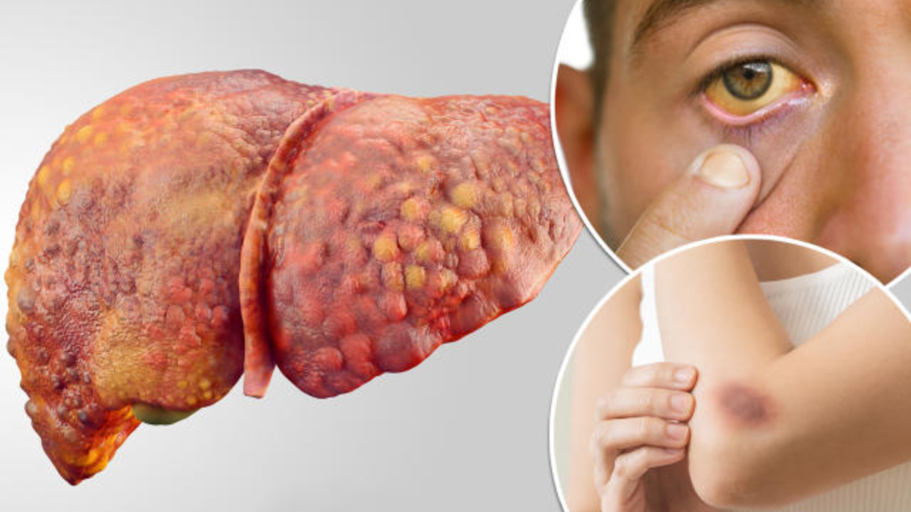 Most Common Symptoms of Liver Problems
