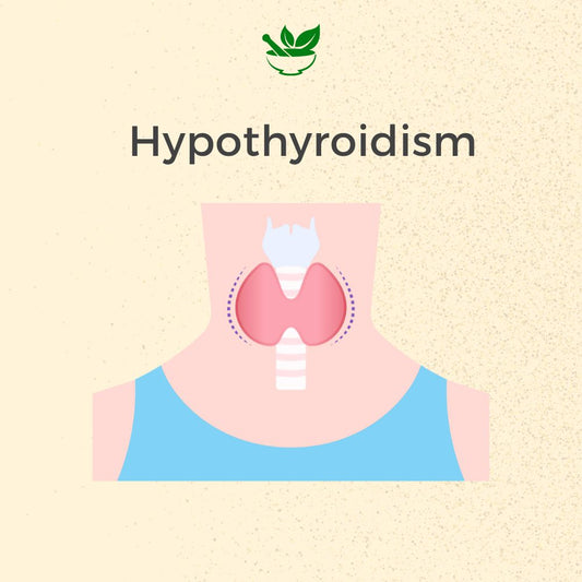 Hypothyroidism Care Ayurvedic Management 30 Days Pack - Deep Ayurveda India