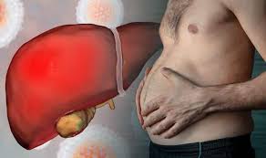 Liver Swelling Symptoms