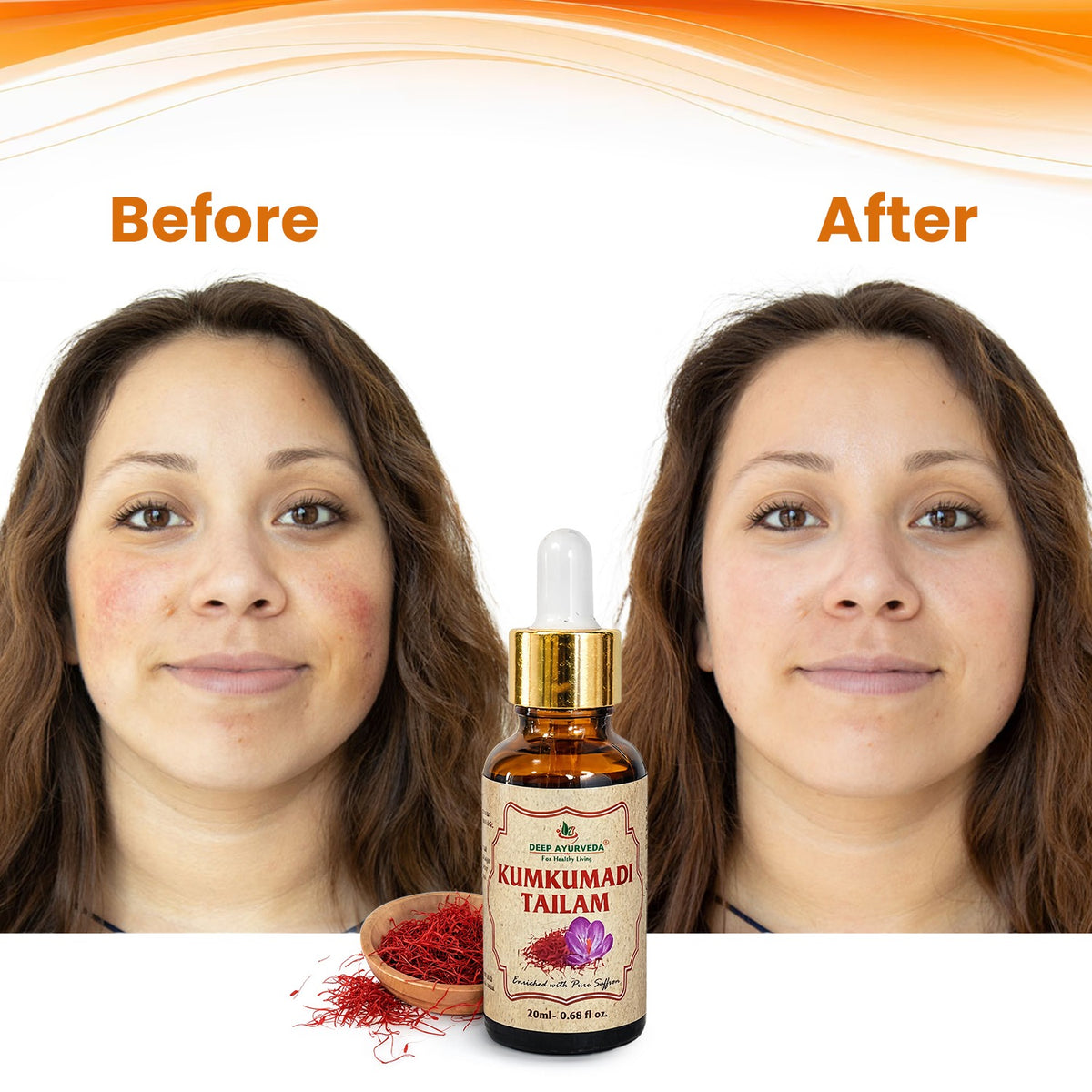 केसर से समृद्ध कुमकुमादि तेल | शानदार और शक्तिशाली चेहरे का तेल | 20ml