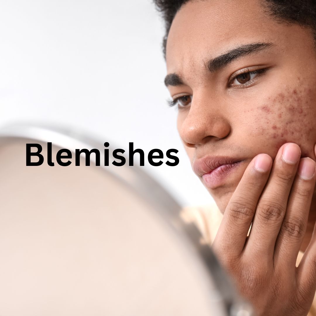 blemishes treatment