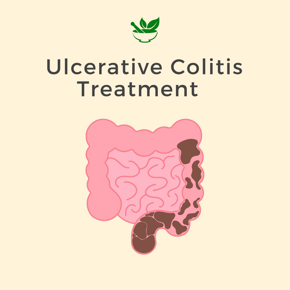Ulcerative Colitis Treatment Ayurvedic Management 30 Days Pack