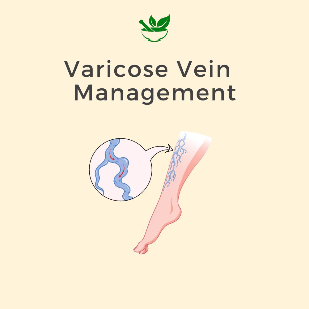 Varicose Vein Ayurvedic Management 30 Days Pack - Deep Ayurveda India