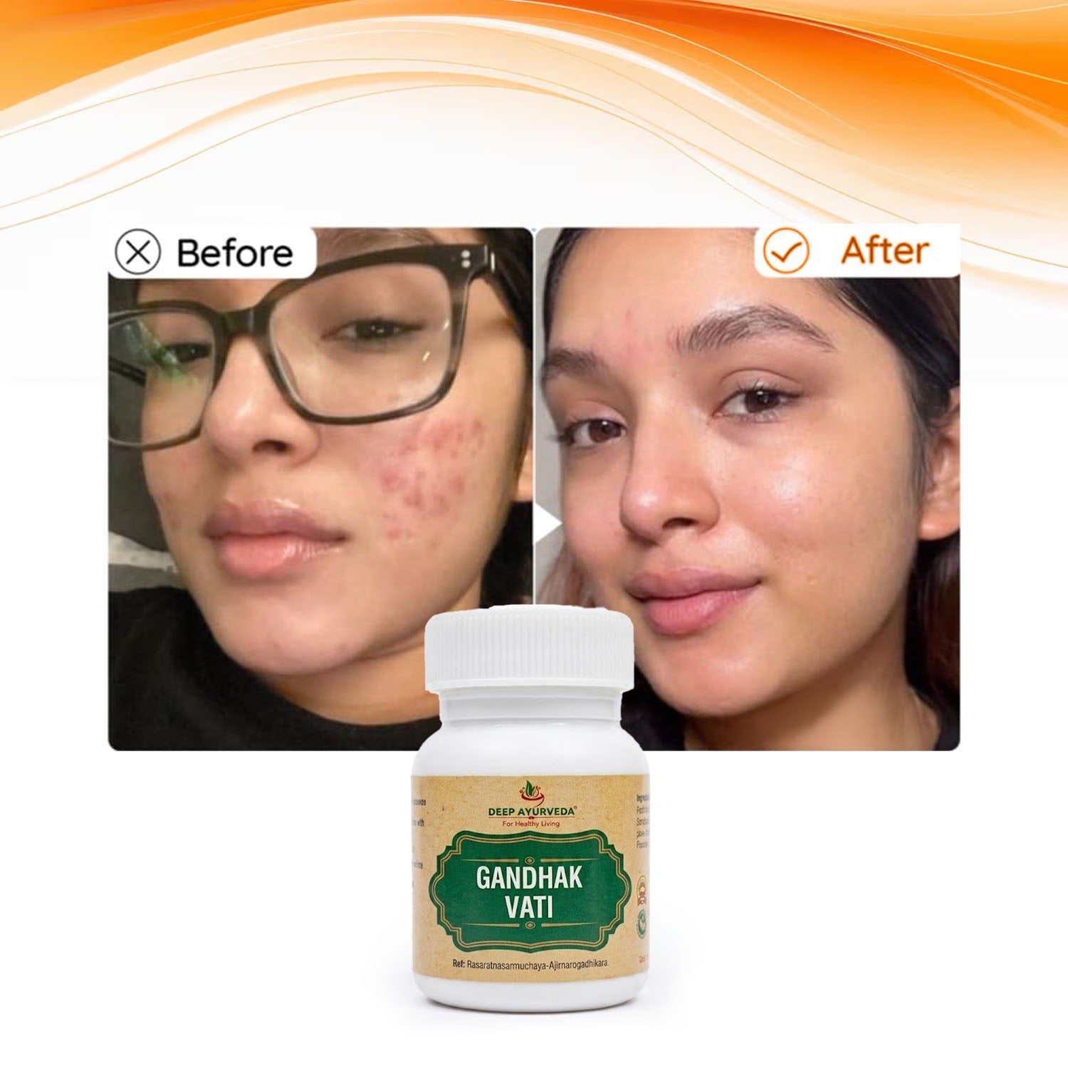 Gandhak Vati - Promotes Skin Health, Supports Detoxification & Immune Health