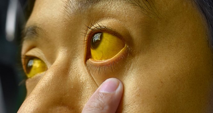 Deep Ayurveda India