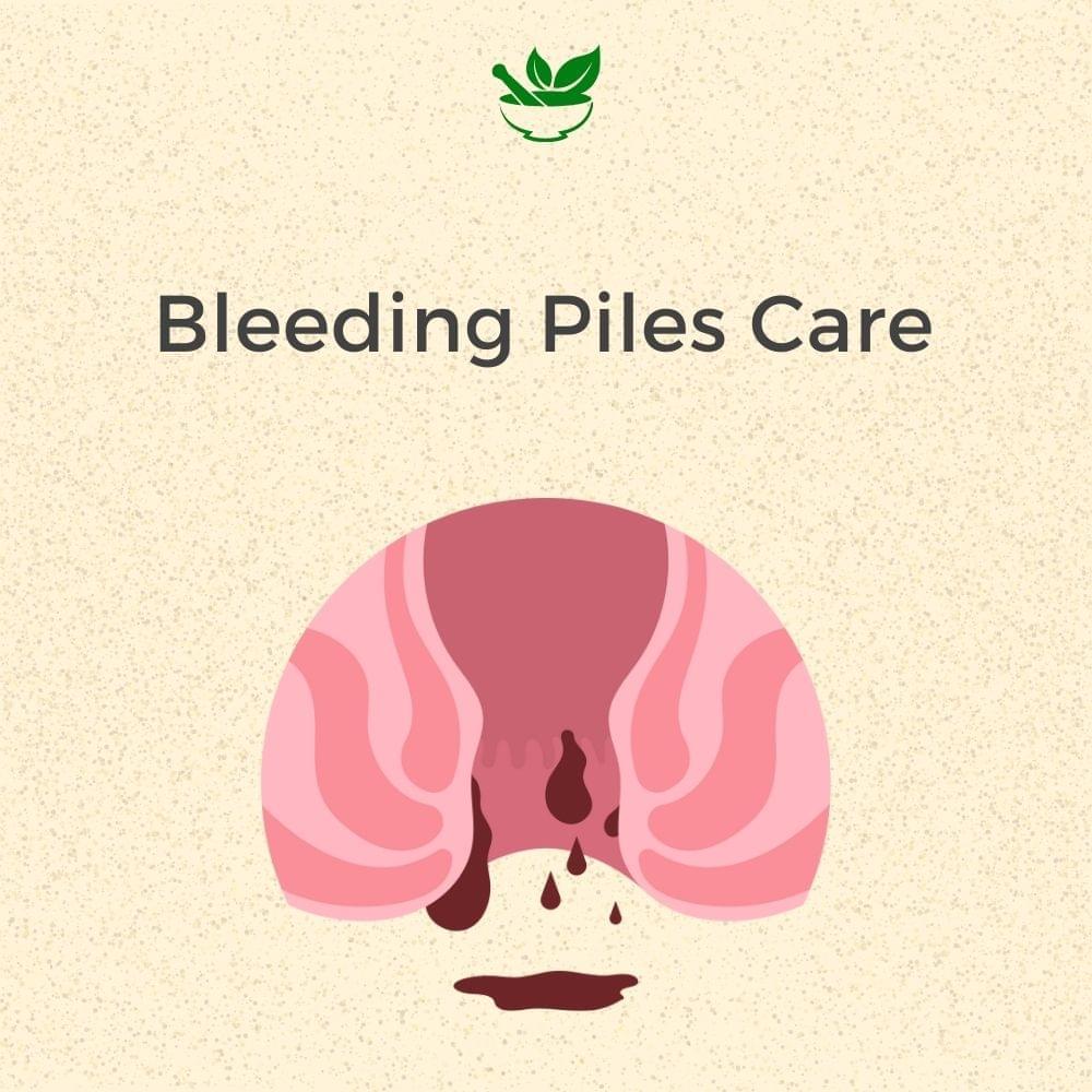 Bleeding Piles Ayurvedic Management 30 Days Pack - Deep Ayurveda India