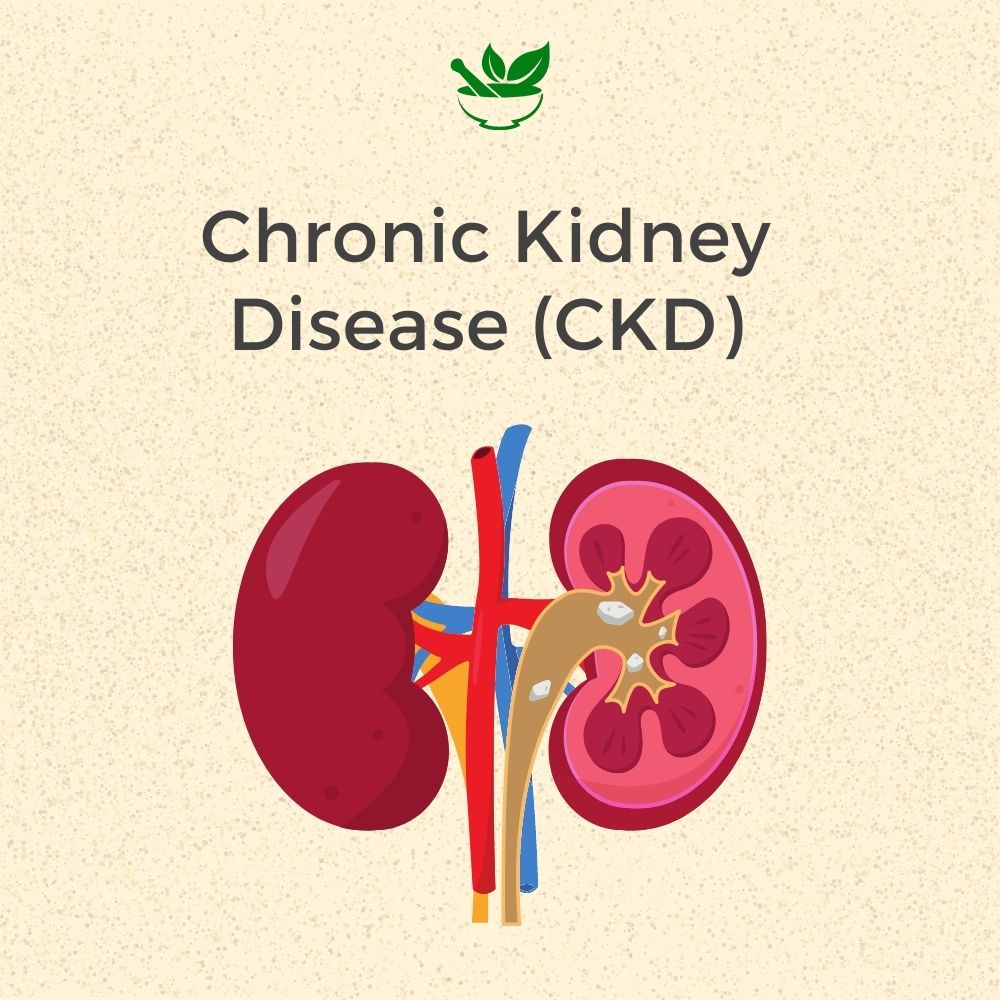 Chronic Kidney Disease (CKD) Ayurvedic Management 30 Days Pack