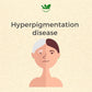 Anti Hyperpigmentation Ayurvedic Management 30 Days Pack - Deep Ayurveda India