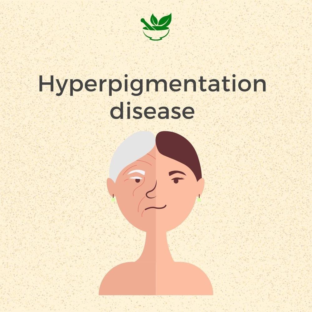 Anti Hyperpigmentation Ayurvedic Management 30 Days Pack