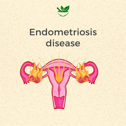 Endometriosis Ayurvedic Management 30 Days Pack - Deep Ayurveda India