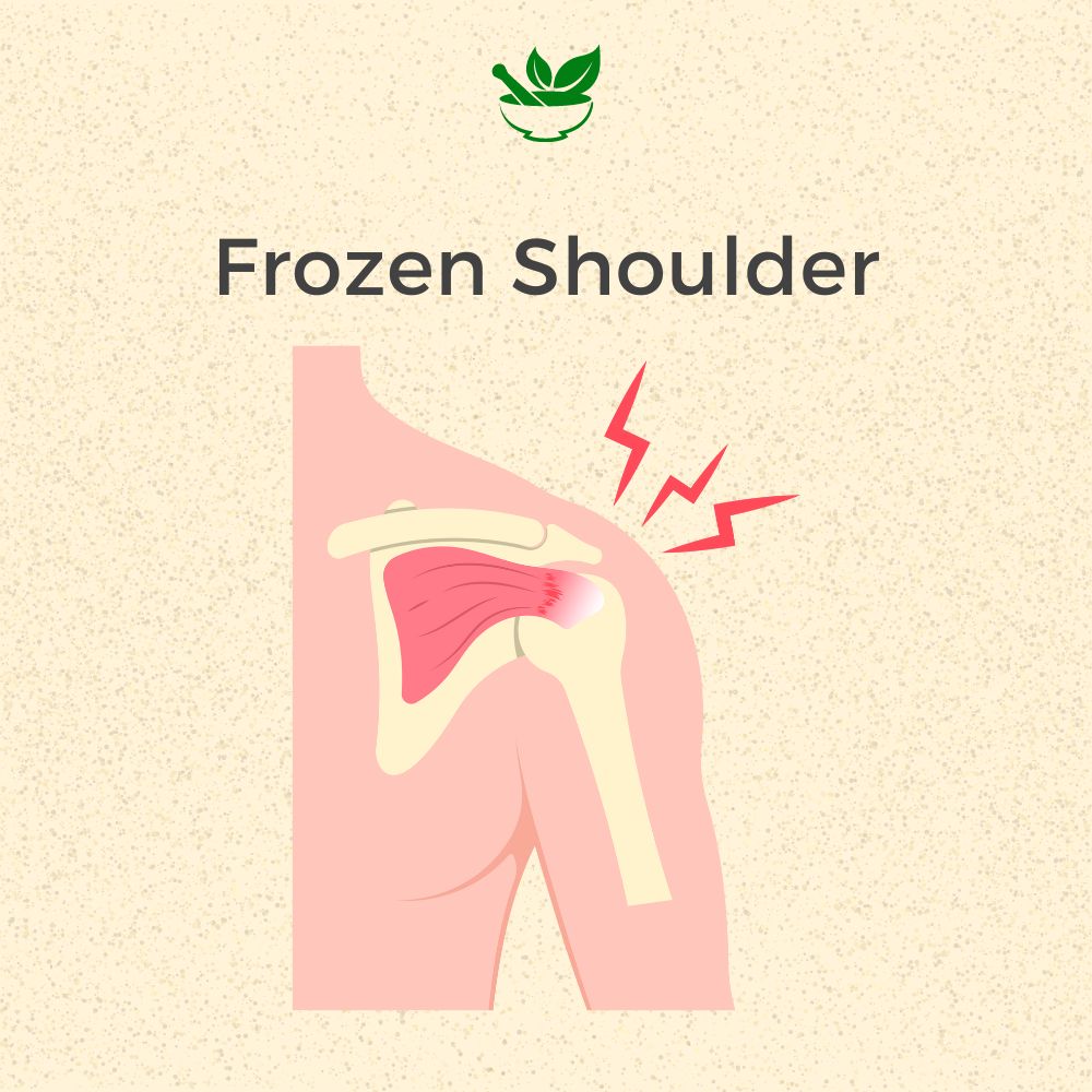 Frozen Shoulder Ayurvedic Management 30 Days Pack - Deep Ayurveda India