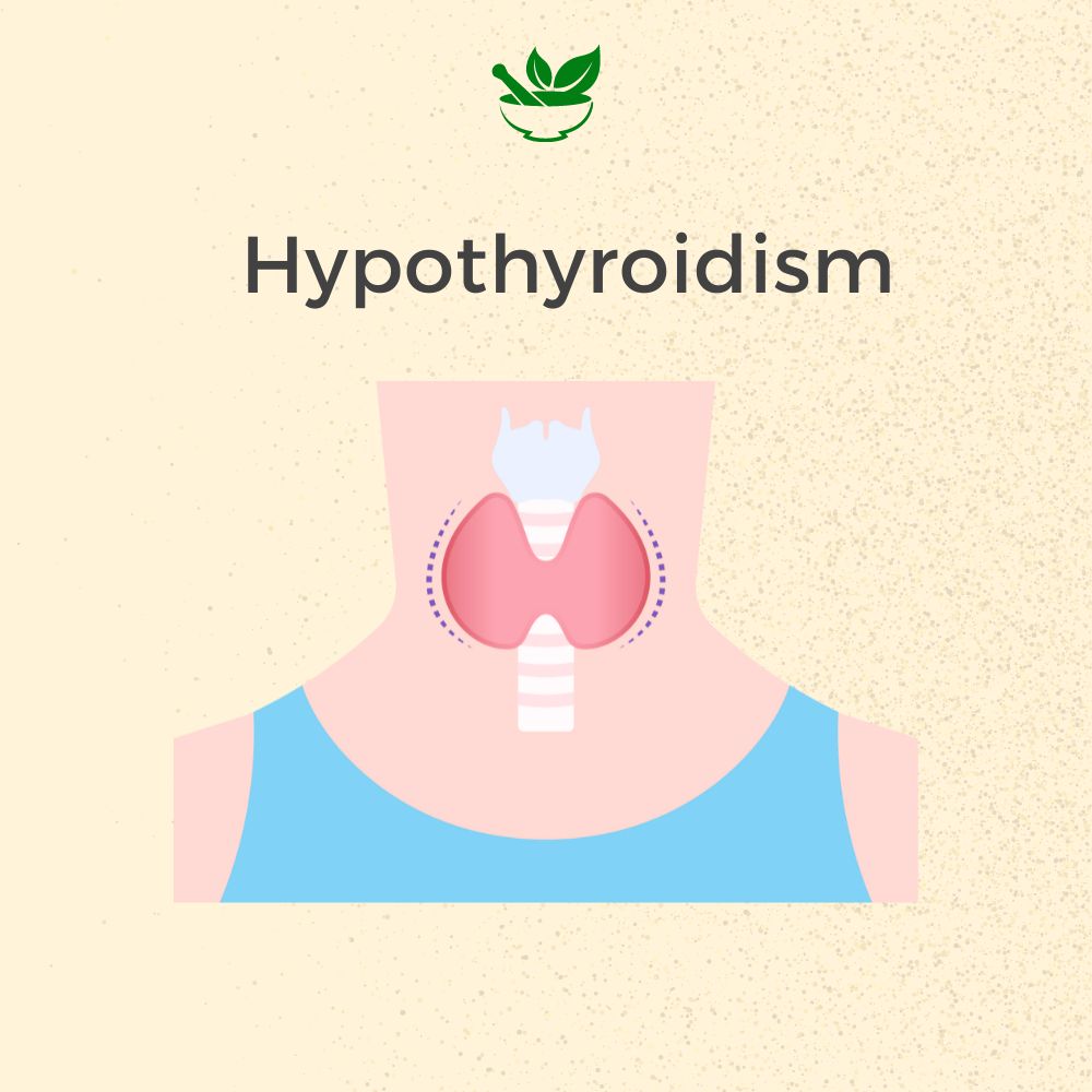 Hypothyroidism Care Ayurvedic Management 30 Days Pack
