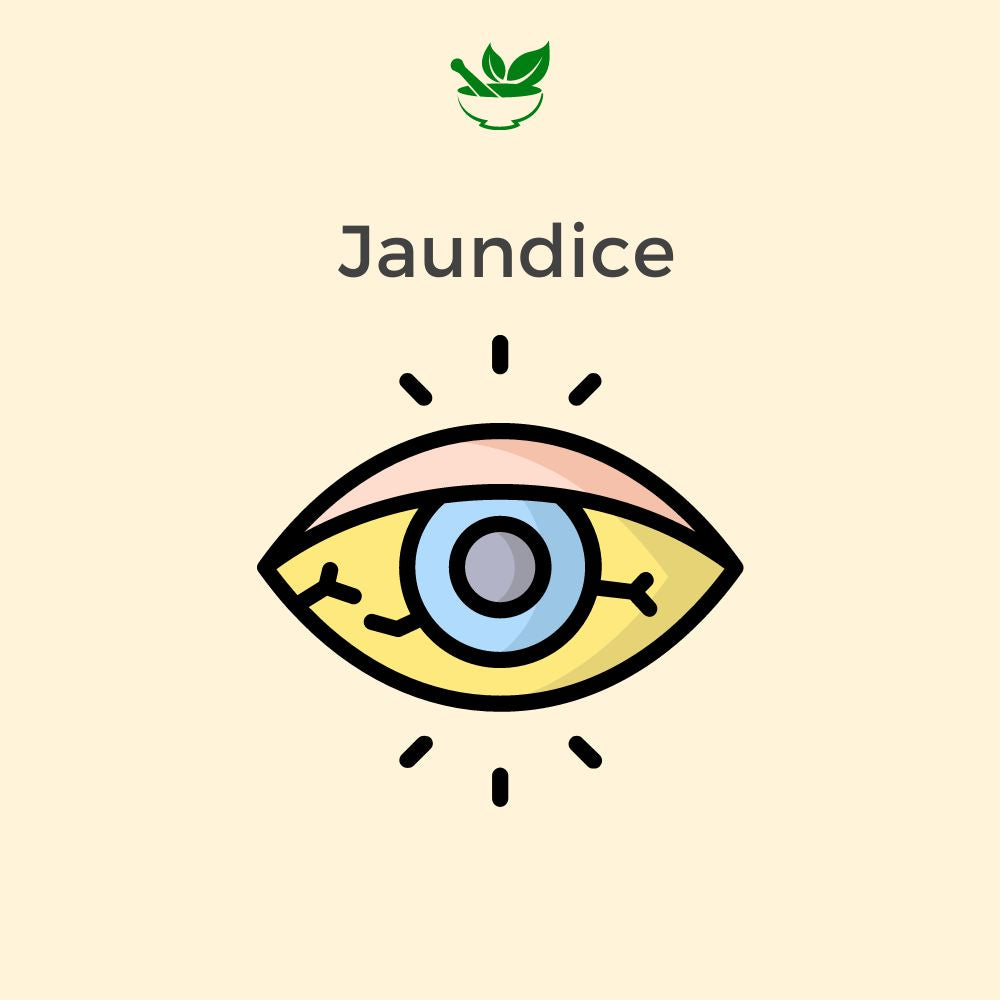 Jaundice Ayurvedic Management 30 Days Pack - Deep Ayurveda India